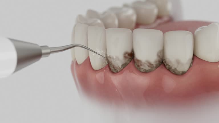 Reliable Dental contractor in Tucker, GA by Dentist Open Now